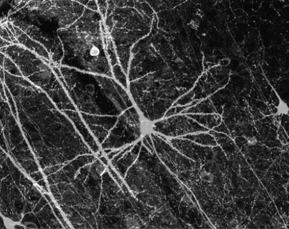 A single cortical neuron with dendrites radiating across a dark field.